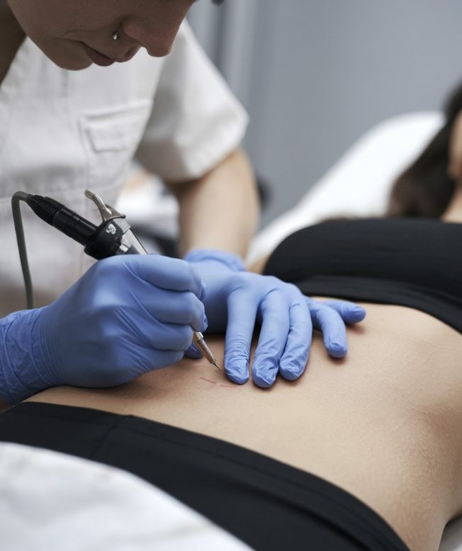 scar camouflage wexford