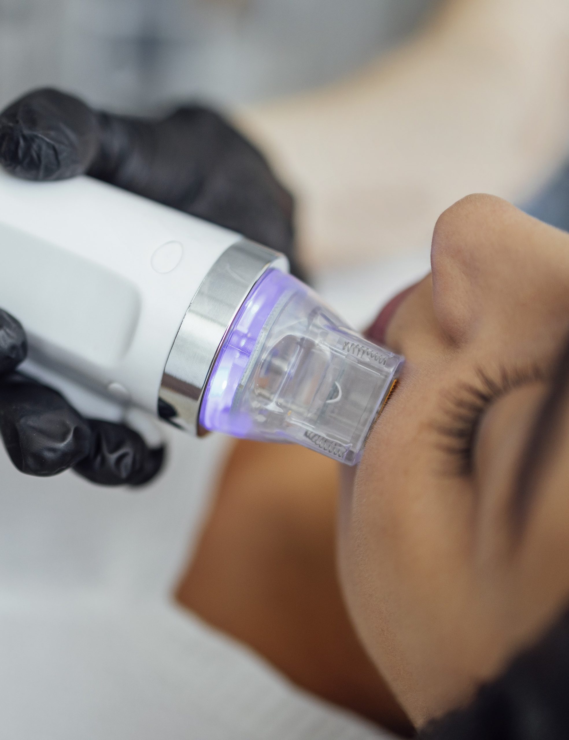 Microneedling Cecil, PA